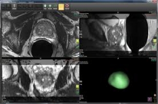 Philips IntelliSpace Portal for CT and MRI