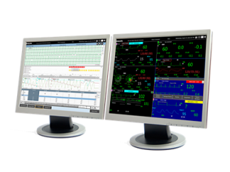 IntelliVue Patient Information Center iX Telemetry System